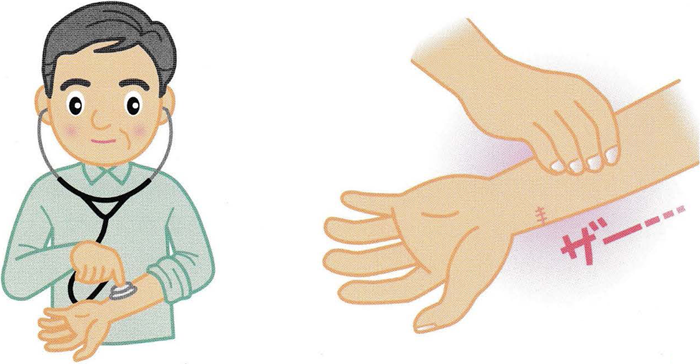 シャントの狭窄・閉塞