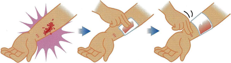 出血が多くて止まらない