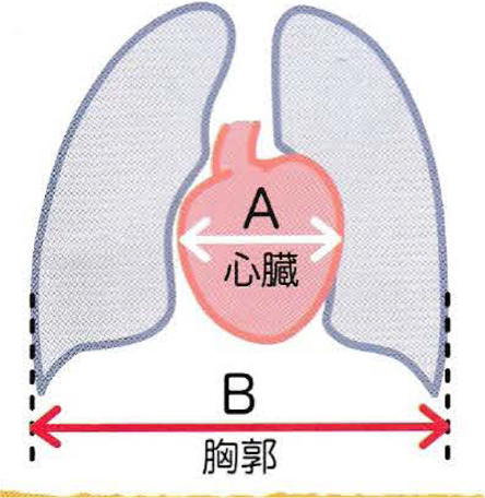心胸比(CTR)とは
