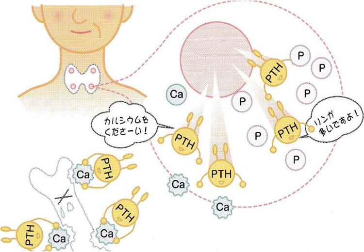 二次性副甲状腺機能亢進症