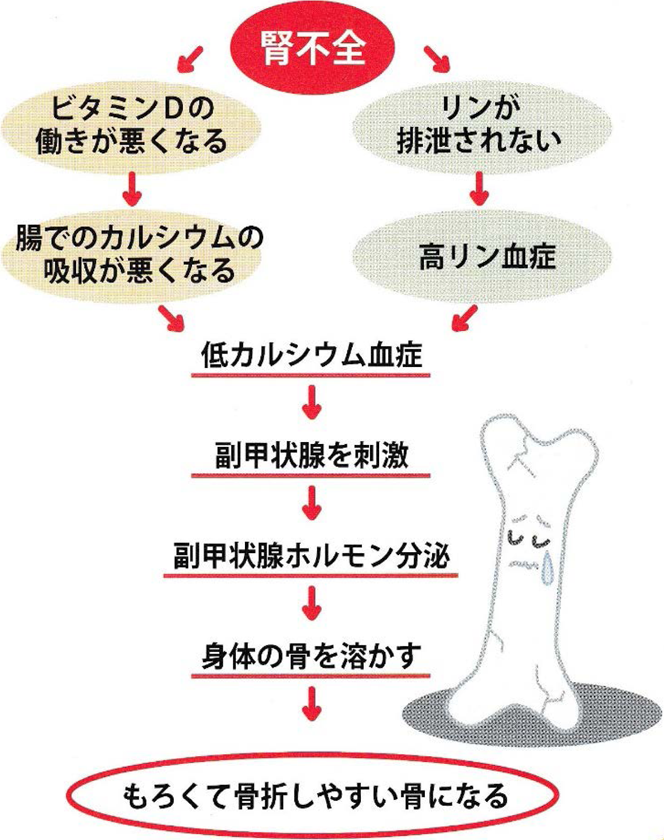 もろくて骨折しやすい骨になる
